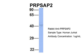 PRPSAP2 Rabbit Polyclonal Antibody
