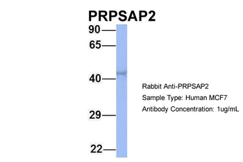 PRPSAP2 Rabbit Polyclonal Antibody