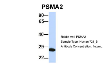 PSMA2 Rabbit Polyclonal Antibody