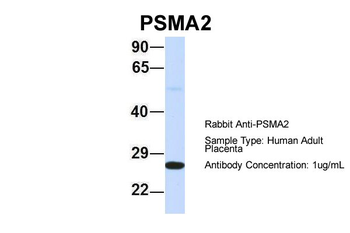 PSMA2 Rabbit Polyclonal Antibody