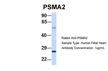 PSMA2 Rabbit Polyclonal Antibody