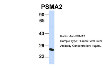 PSMA2 Rabbit Polyclonal Antibody