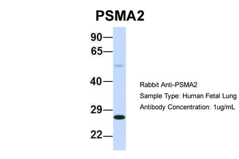 PSMA2 Rabbit Polyclonal Antibody