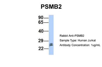 PSMB2 Rabbit Polyclonal Antibody