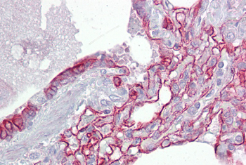 PTPN11 Rabbit Polyclonal Antibody