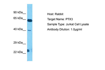 PTX3 Rabbit Polyclonal Antibody