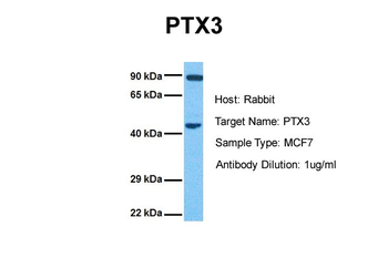 PTX3 Rabbit Polyclonal Antibody