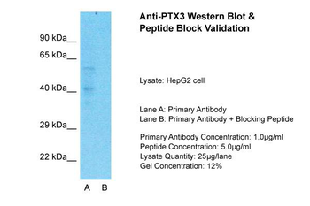 PTX3 Rabbit Polyclonal Antibody