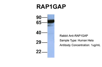 RAP1GAP Rabbit Polyclonal Antibody