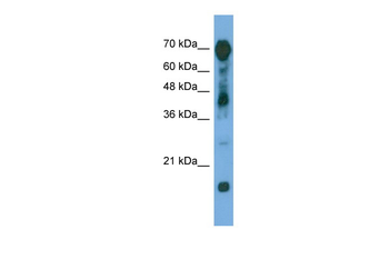 RAP1GAP Rabbit Polyclonal Antibody