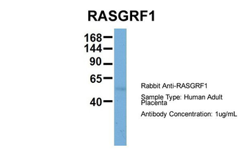 RASGRF1 Rabbit Polyclonal Antibody