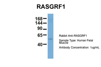 RASGRF1 Rabbit Polyclonal Antibody