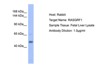 RASGRF1 Rabbit Polyclonal Antibody