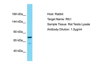 Rfc1 Rabbit Polyclonal Antibody