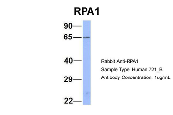 RPA1 Rabbit Polyclonal Antibody