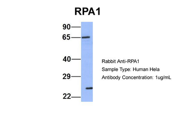 RPA1 Rabbit Polyclonal Antibody