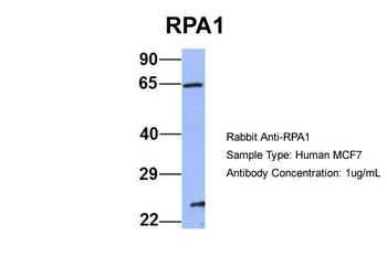RPA1 Rabbit Polyclonal Antibody