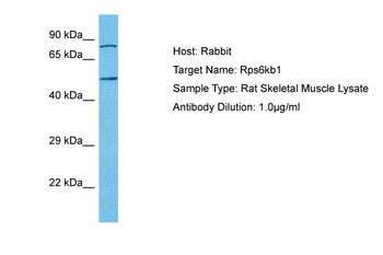 RPS6KB1 Rabbit Polyclonal Antibody