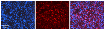 RPS6KB1 Rabbit Polyclonal Antibody