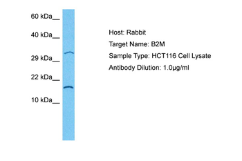 B2M Rabbit Polyclonal Antibody