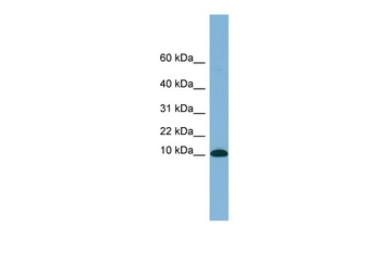 B2M Rabbit Polyclonal Antibody