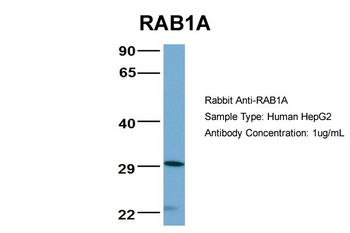 RAB1A Rabbit Polyclonal Antibody