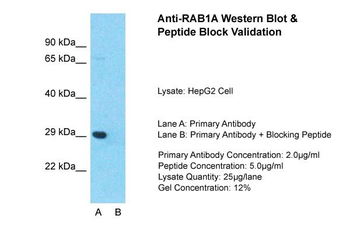 RAB1A Rabbit Polyclonal Antibody