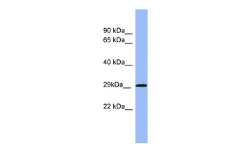 RAB5A Rabbit Polyclonal Antibody