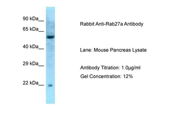 Rab27a Rabbit Polyclonal Antibody