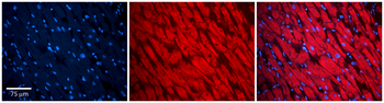 PKP2 Rabbit Polyclonal Antibody