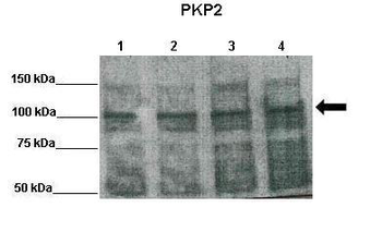 PKP2 Rabbit Polyclonal Antibody
