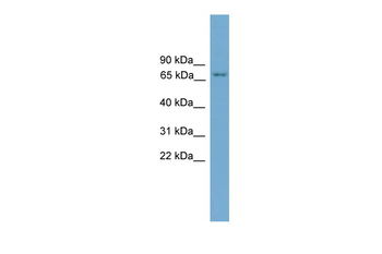 PRKCH Rabbit Polyclonal Antibody