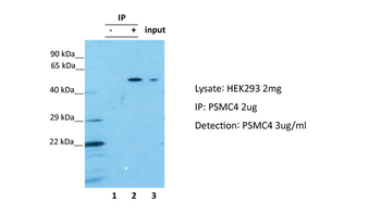 PSMC4 Rabbit Polyclonal Antibody