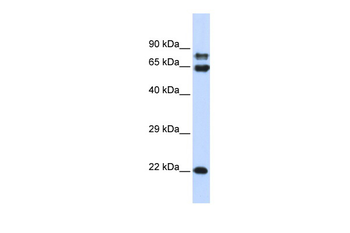 PPP2R1A Rabbit Polyclonal Antibody