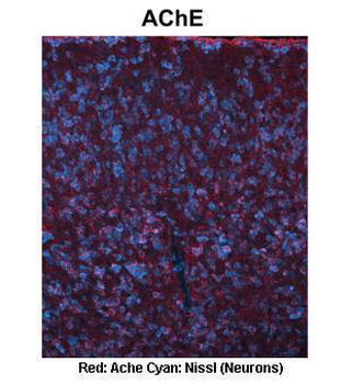 ACHE Rabbit Polyclonal Antibody
