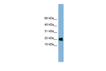GOLGA7 Rabbit Polyclonal Antibody