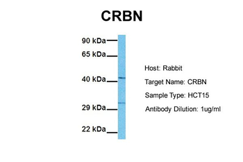 CRBN Rabbit Polyclonal Antibody
