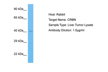 CRBN Rabbit Polyclonal Antibody