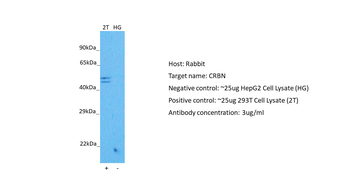 CRBN Rabbit Polyclonal Antibody