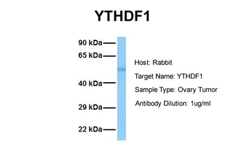YTHDF1 Rabbit Polyclonal Antibody