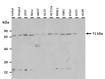 CRTAC1 Rabbit Polyclonal Antibody