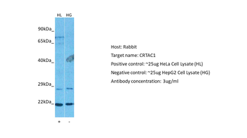 CRTAC1 Rabbit Polyclonal Antibody