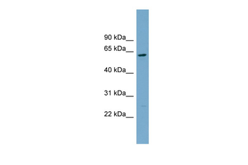 CNDP2 Rabbit Polyclonal Antibody