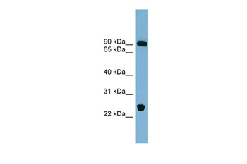 VPS53 Rabbit Polyclonal Antibody