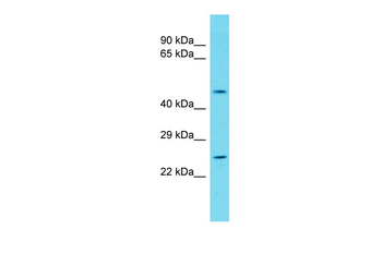 Ddit4 Rabbit Polyclonal Antibody