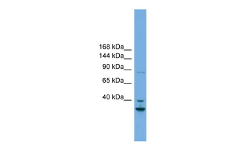 FSTL5 Rabbit Polyclonal Antibody