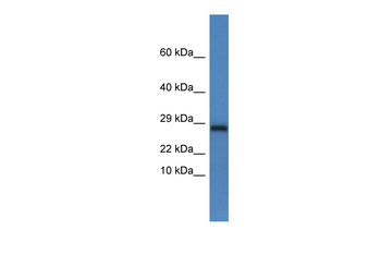 Ndufv2 Rabbit Polyclonal Antibody