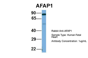AFAP1 Rabbit Polyclonal Antibody
