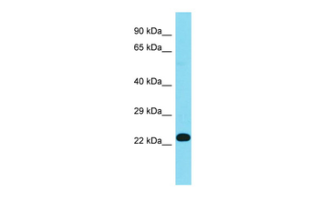 Fn3k Rabbit Polyclonal Antibody