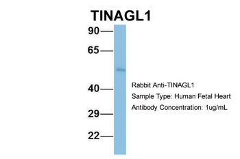 TINAGL1 Rabbit Polyclonal Antibody
